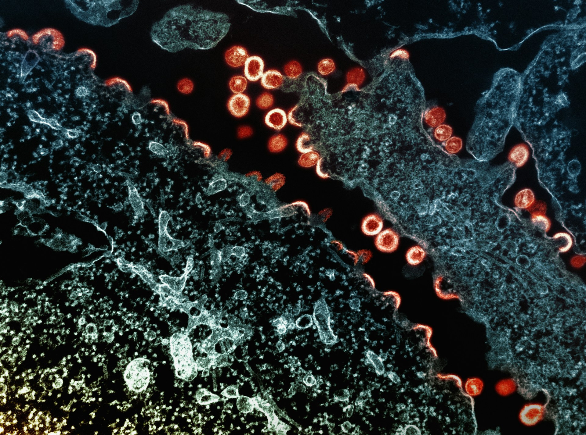 Aerobic Digestion Composting